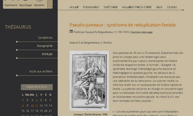 Site internet WordPress pour l’association PNG86